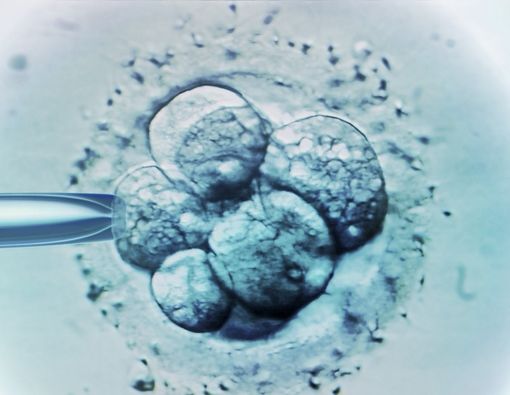 Risiko Diabetes pada Wanita Hamil yang Menggunakan IVF