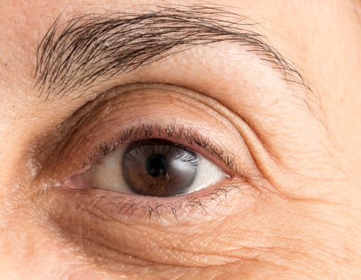 Penyebab Mata Tua sebelum Usia 40 Tahun