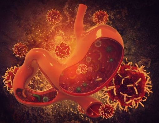 Pemanfaatan Robot pada Operasi Kanker Lambung dan Kolorektal