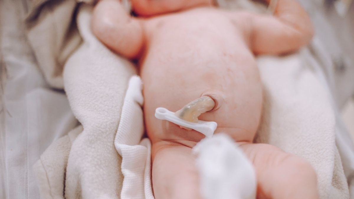 Manfaat Menunda Penjepitan Tali Pusat pada Bayi Baru Lahir