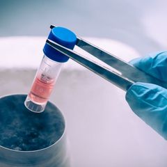 Stem Cell Berpotensi Jadi Pengobatan Diabetes