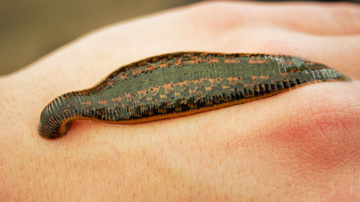 Minyak Lintah Bisa Bikin Kulit Mulus, Benarkah?