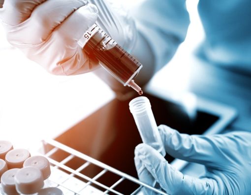 AS Uji Coba Terapi Plasma Darah untuk Mengobati Infeksi Virus Corona