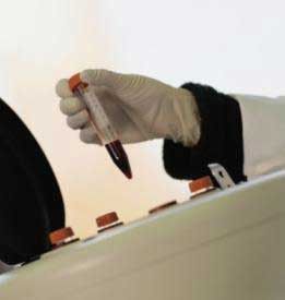 Tes Darah Penentu Heart Attack