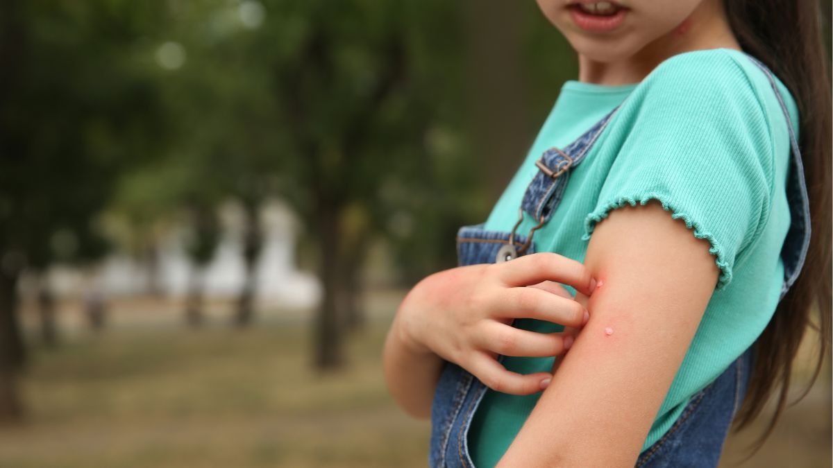 Siapa Saja yang Berisiko Terkena Scabies?