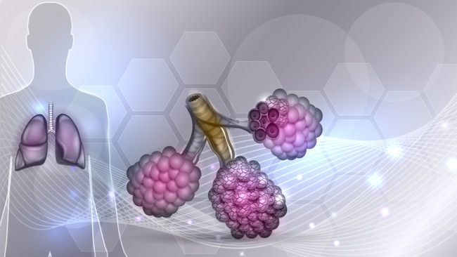 Kenali Cystic Fibrosis, Penyakit Perusak Paru-paru