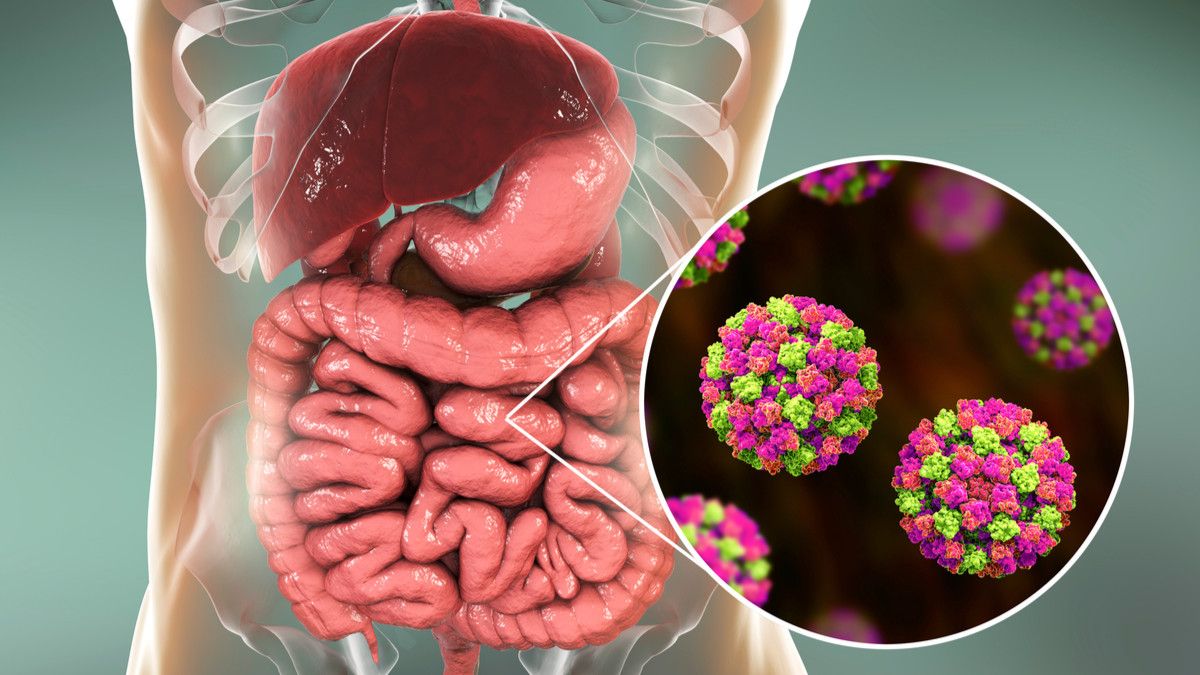 Penyakit akibat Norovirus, Benarkah Bukan Diare Biasa?