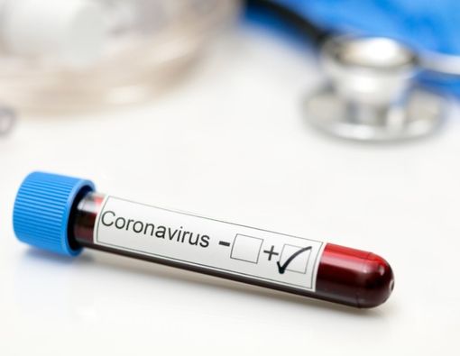 Klorokuin Disebut sebagai Obat Virus Corona, Kenali Kandungannya!