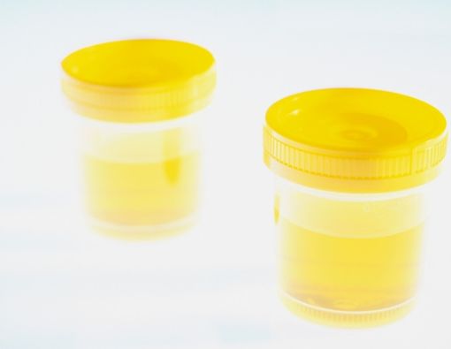 Penyebab Urine Bau Saat Masa Kehamilan