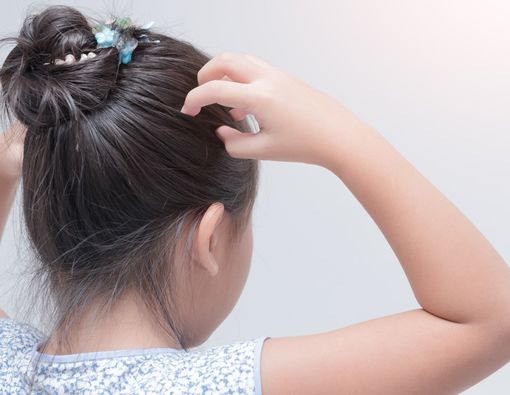 Cara Praktis Atasi Ketombe dan Rambut Rontok pada Anak