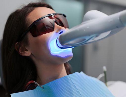 Pemutihan Gigi dengan Laser, Apakah Efektif?