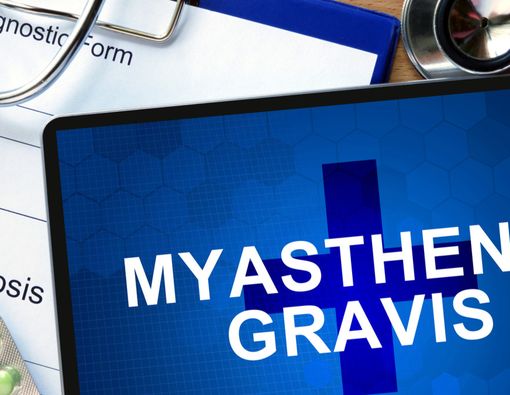 Myasthenia Gravis