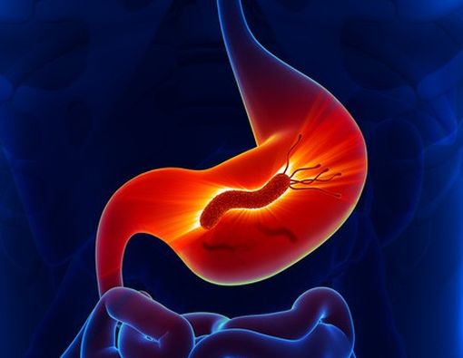 Berbahayakah Jika Punya Maag?