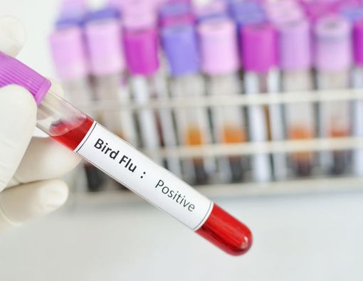 3 Sebab Penyebaran Virus Flu Burung Makin Meluas