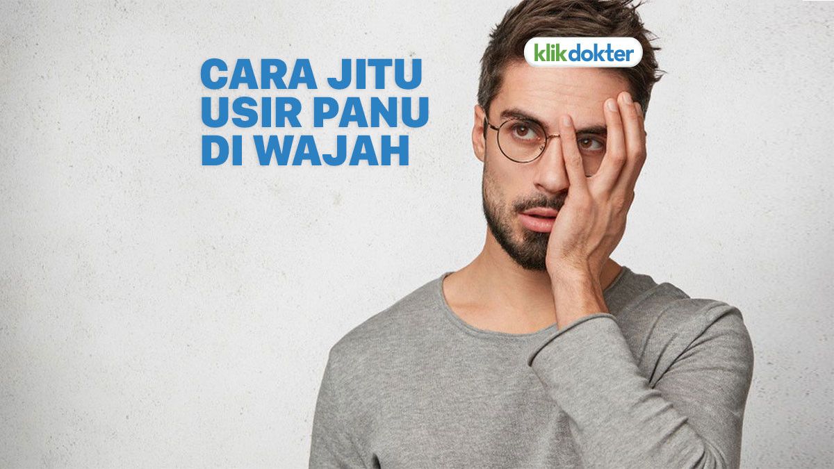 Cara Menghilangkan Panu di Wajah