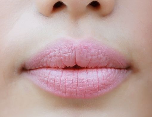 6 Solusi Bibir Pecah-pecah