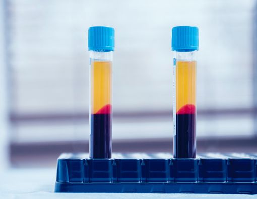 Manfaat Terapi Plasma Darah untuk Kecantikan