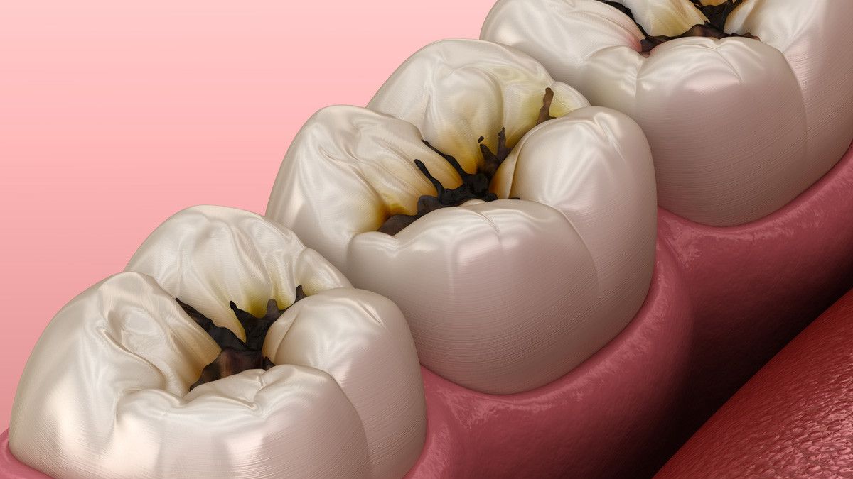 Tanda Penyakit Rongga Mulut yang Jarang Disadari
