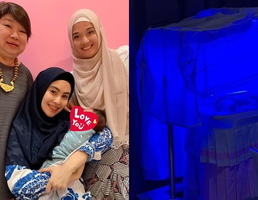 Penyebab Bayi Sakit Kuning seperti Anak Kartika Putri