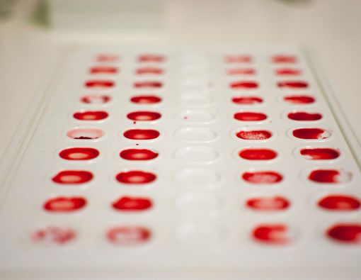 Golongan Darah Tentukan Parahnya Penyakit Akibat E. Coli