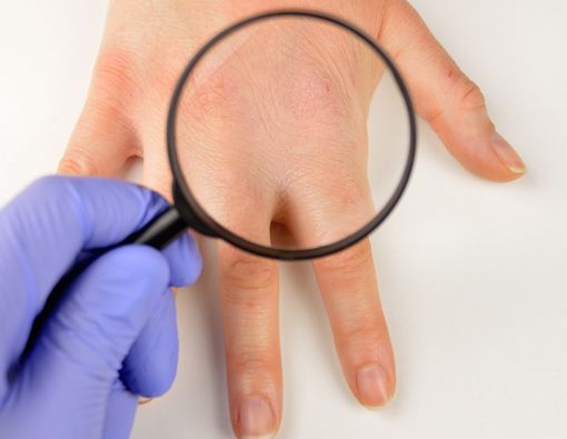 Kenali Cara Imunitas Kulit dalam Melindungi Tubuh