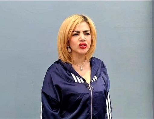 Mau Sulam Bibir seperti Barbie Kumalasari? Kenali Dulu Efek Sampingnya