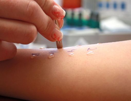 Tes Alergi untuk Anak Autisme, Berbedakah?