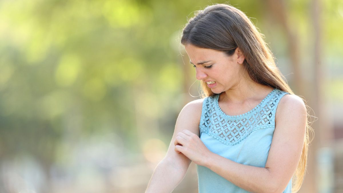 4 Alergi Kulit pada Wanita yang Perlu Anda Tahu