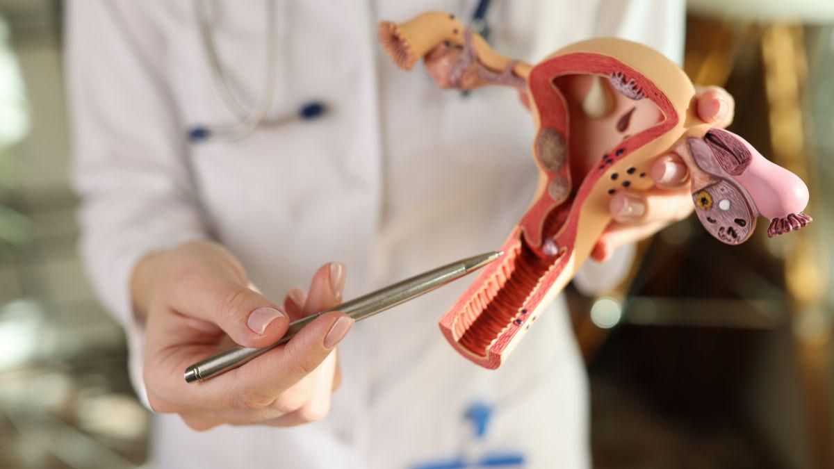 Neisseria Gonorrhoeae