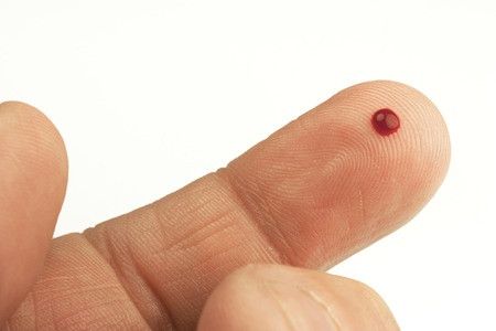 Pertolongan Stroke dengan Mengeluarkan Darah di Ujung Jari adalah Hoax