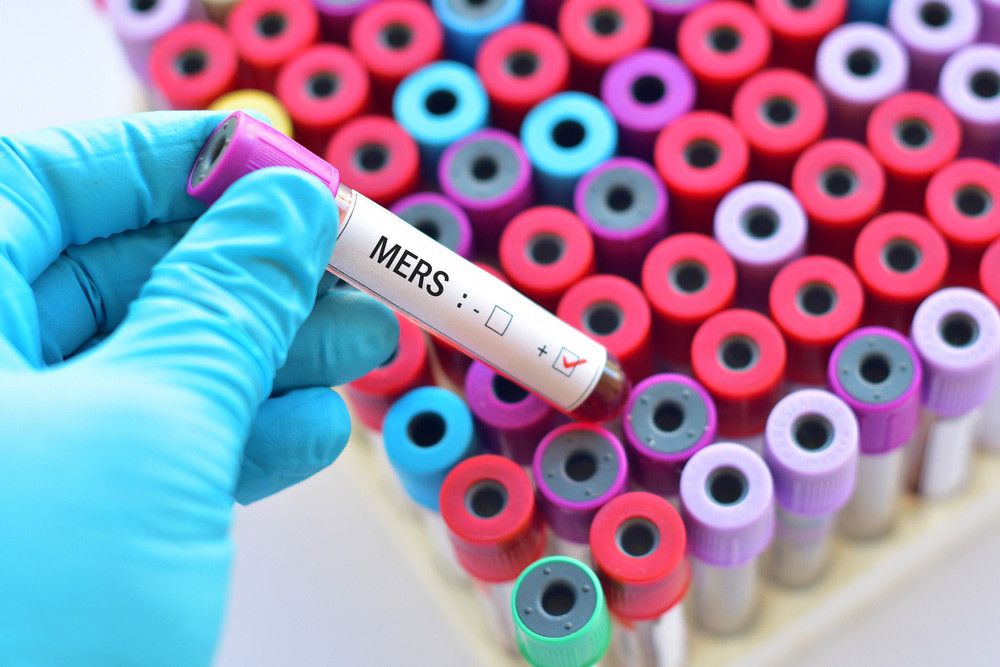 Berkenalan dengan Flu Unta alias MERS