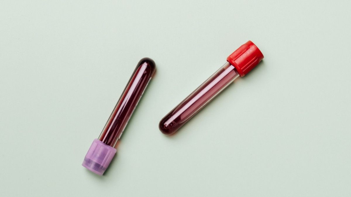 Mengenal IGRA Test, Pemeriksaan Darah untuk Deteksi TBC