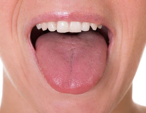 Penyebab Mulut Terasa Asam, Apakah Berbahaya?