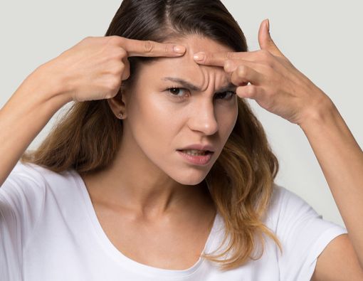 Benarkah Sering Memencet Jerawat Bikin Keloid?