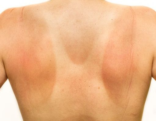 5 Kebiasaan Sehari-hari yang Merusak Kulit