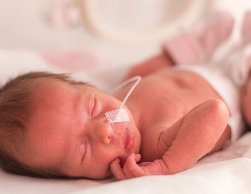 Komplikasi Kesehatan Akibat Sindrom Treacher Collins