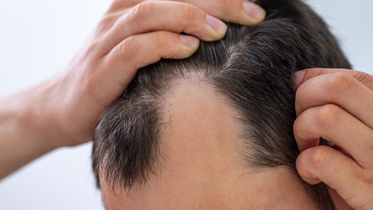 6 Gangguan Kesehatan yang dapat Dideteksi dari Rambut Anda