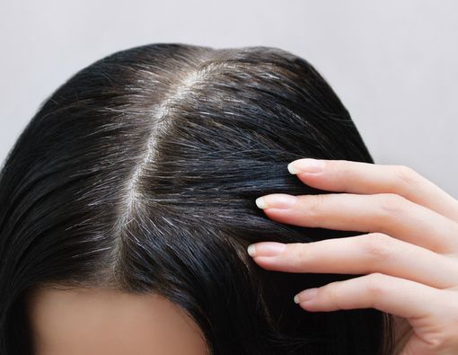 Catat, Ini 11 Penyebab Uban Muncul di Usia Muda