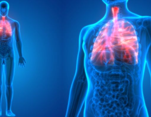 Jenis Terapi Alternatif untuk Pengobatan Kanker Paru