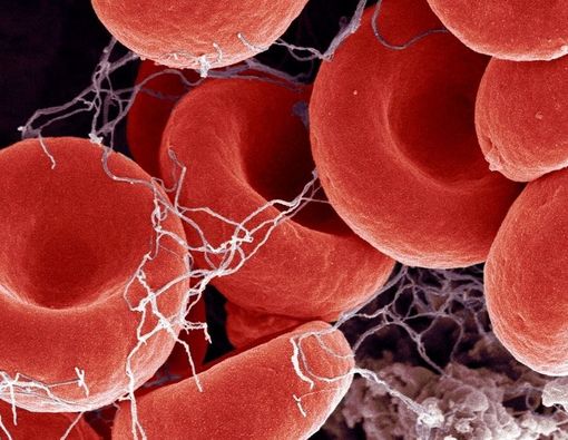 Efek Gangguan Pembekuan Darah pada Tubuh