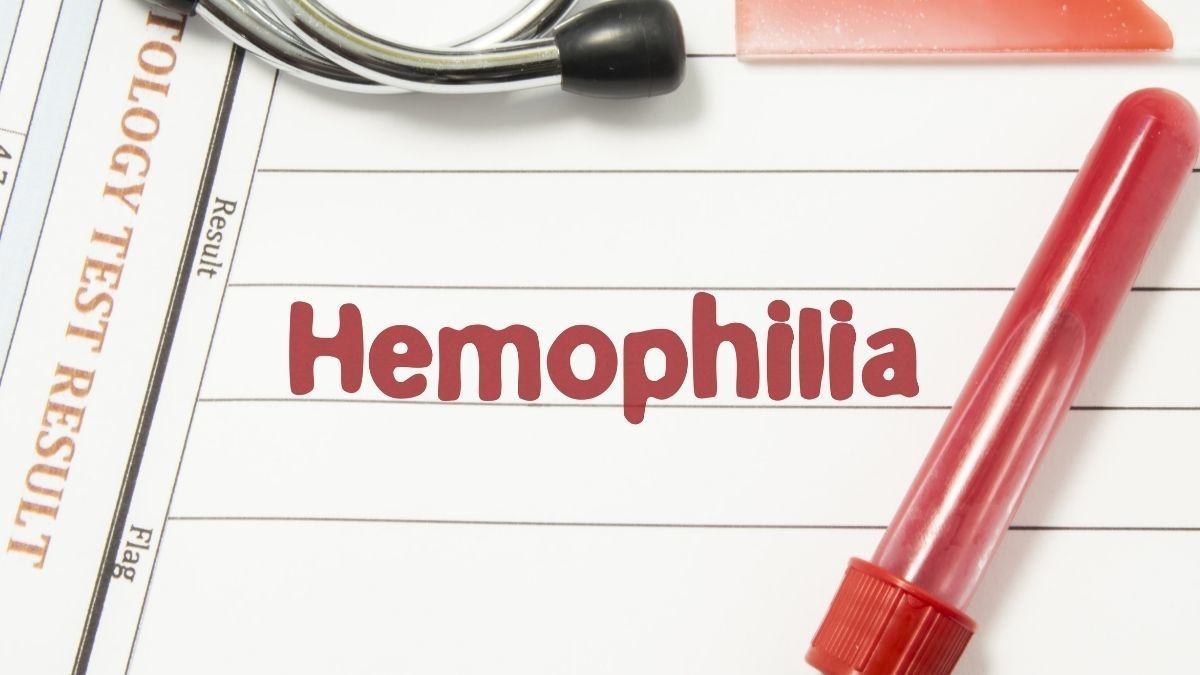Bahaya Komplikasi Hemofilia yang Harus Anda Waspadai