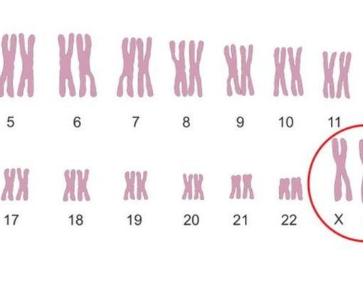 Sindrom Super Female