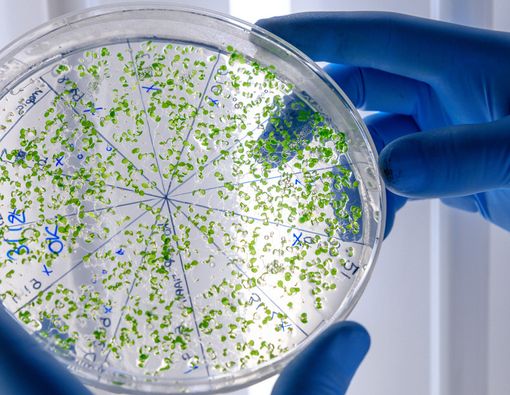 Mengenal Germophobia, Rasa Takut Berlebih Terhadap Bakteri