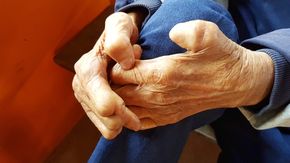 5 Tips Mencegah Tertular Penyakit Kusta