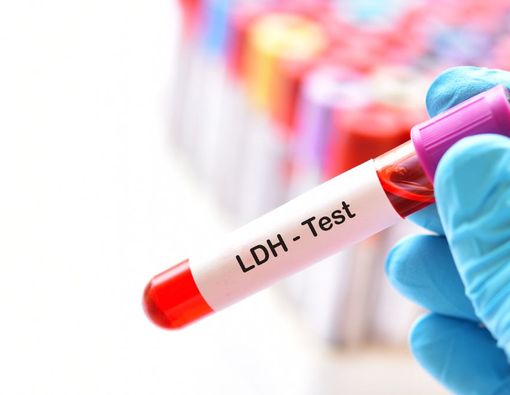 Pemeriksaan LDH: Fungsi, Manfaat, dan Hasil Normalnya