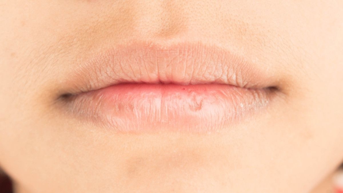 Penyebab Bibir Terasa Kebas dan Kesemutan