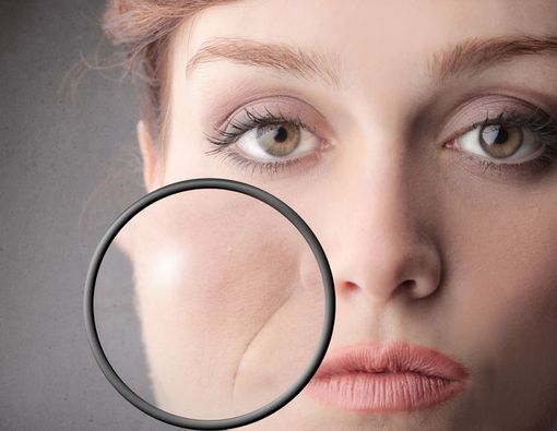 Usia Muda Tak Berarti Bebas Keriput