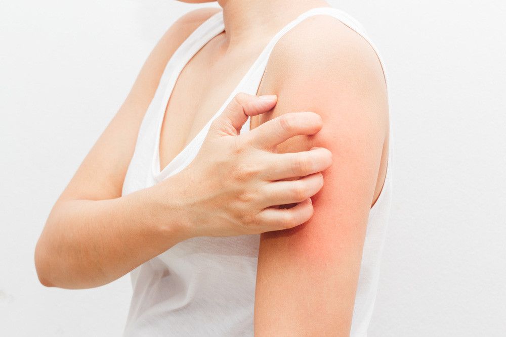 5 Penyakit Kulit yang Rentan Mewabah di Musim Kemarau (NamtopStudio/Shutterstock)