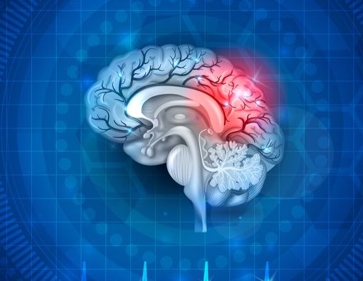 Cegah Stroke dengan 9 Cara Mudah Ini