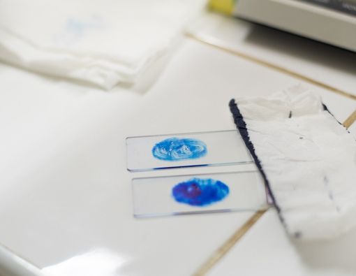 Prosedur Tes Dahak untuk Diagnosis TBC